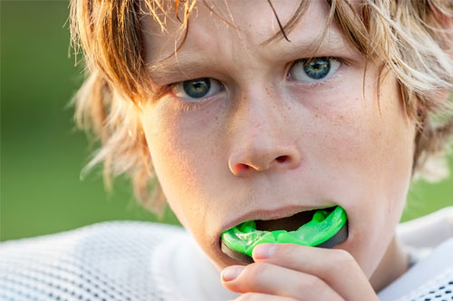 Reasons to Get a Custom Mouthguard